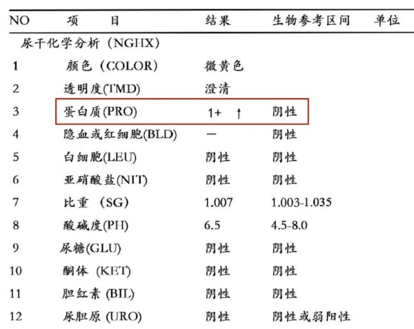 蚂蚁策略 肾脏彻底罢工前，曾用4个信号提醒过你！不是腰疼